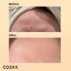 cosrx advanced snail 96 mucin power essence 100ml, skin repair & hydrating serum